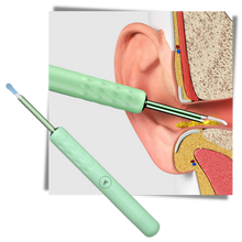 Carica l'immagine nel visualizzatore di Gallery, Bastone intelligente per la pulizia dell'orecchio - Ozerty