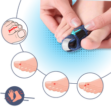 Carica l'immagine nel visualizzatore di Gallery, Raddrizzatore per dita dei piedi regolabile e discreto - Ozerty