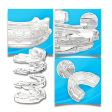 Carica l'immagine nel visualizzatore di Gallery, Dispositivo antirussamento avanzato - Ozerty