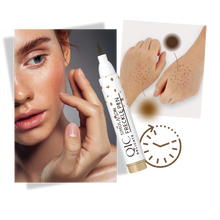 Carica l'immagine nel visualizzatore di Gallery, Penna per Lentiggini a Finitura Naturale - Ozerty