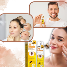 Carica l'immagine nel visualizzatore di Gallery, Rimuovi Escrescenze Cutanee Non-Invasivo - Ozerty