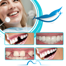 Carica l'immagine nel visualizzatore di Gallery, Kit per la Modellazione di Denti Finti Riutilizzabile - Ozerty