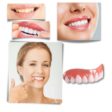 Carica l'immagine nel visualizzatore di Gallery, Faccette dentali a scatto - Ozerty