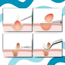 Carica l'immagine nel visualizzatore di Gallery, Pinzette a punta ultra precise - Ozerty