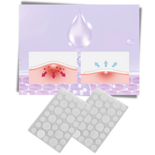 Carica l&#39;immagine nel visualizzatore di Gallery, Confezione da 36 cerotti invisibili per l&#39;acne - Ozerty
