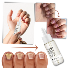 Carica l&#39;immagine nel visualizzatore di Gallery, Essenza per la riparazione delle unghie 7 giorni - Ozerty
