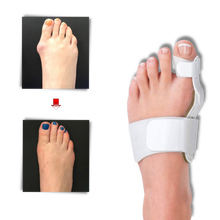 Carica l&#39;immagine nel visualizzatore di Gallery, Correttore ortopedico di alluce valgo - Ozerty
