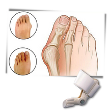 Carica l&#39;immagine nel visualizzatore di Gallery, Correttore ortopedico di alluce valgo - Ozerty
