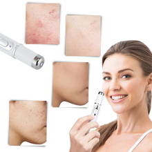 Carica l&#39;immagine nel visualizzatore di Gallery, Penna per la terapia della pelle a luce blu - Ozerty
