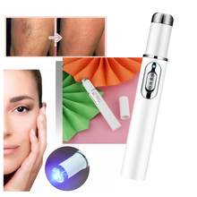 Carica l&#39;immagine nel visualizzatore di Gallery, Penna per la terapia della pelle a luce blu - Ozerty
