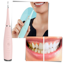 Carica l&#39;immagine nel visualizzatore di Gallery, Macchina per la pulizia profonda del tartaro dei denti - Ozerty
