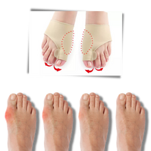 Carica l&#39;immagine nel visualizzatore di Gallery, Correttore di alluce valgo in gel
