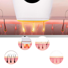 Carica l&#39;immagine nel visualizzatore di Gallery, Laser IPL per la rimozione dei peli portatile
