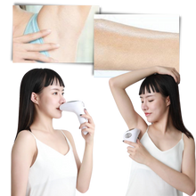 Carica l&#39;immagine nel visualizzatore di Gallery, Laser IPL per la rimozione dei peli portatile  - Ozerty
