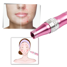 Carica l&#39;immagine nel visualizzatore di Gallery, Penna per micro-needling dermico - Ozerty
