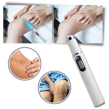 Carica l&#39;immagine nel visualizzatore di Gallery, Penna laser blu per la rimozione delle macchie scure - Ozerty
