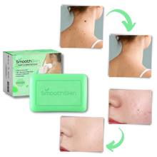 Carica l&#39;immagine nel visualizzatore di Gallery, Esfoliante idratante Sapone per la rimozione delle verruche - Ozerty
