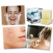 Carica l&#39;immagine nel visualizzatore di Gallery, Sapone antiacne naturale al sale marino - Ozerty
