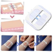 Carica l&#39;immagine nel visualizzatore di Gallery, Adesivo per ferite impermeabile - Ozerty
