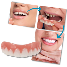 Carica l&#39;immagine nel visualizzatore di Gallery, Faccette dentali a scatto - Ozerty
