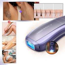 Carica l&#39;immagine nel visualizzatore di Gallery, Dispositivo di Depilazione SkinSync - Ozerty
